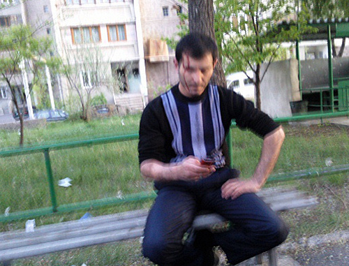 Alexander Akhverdyan, an activist of the ANC, after being attacked; Yerevan, April 22, 2013. Courtesy of the http://www.ilur.am