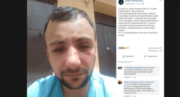 Beaten Vardan Arutyunyan. Screenshot of his Facebook post dated June 3: https://www.facebook.com/photo.php?fbid=2453172568055999&set=a.618587571514517&type=3&theater 