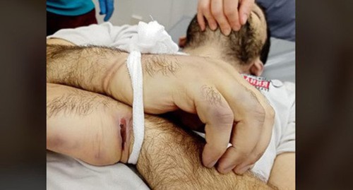 Bruises on Inal Djabiev's body. Screenshot https://www.facebook.com/photo/?fbid=946507415829604&amp;set=pcb.2721689724815819