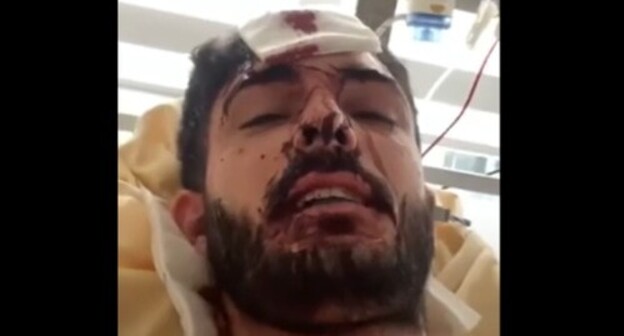 Mukhammed Mirzali after being attacked. Screenshot of the video at the Amon Equalizer YouTube channel https://www.youtube.com/watch?v=nVEhi45e3vg