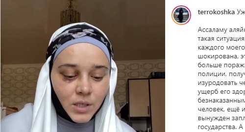 The girl, who moved to Makhachkala because of her religious beliefs, has complained that she was seriously injured in a fight in the hospital. Screenshot of the post https://www.instagram.com/p/CRSEGqEKDtd/