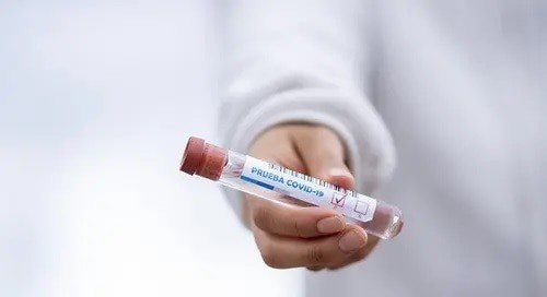 Test tube for PCR test for coronavirus. Photo: pixabay.com